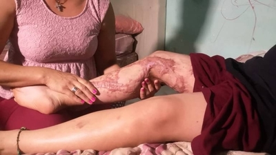 Diario HOY | Niño sufrió quemaduras en desafío de Tik Tok, madre pide ayuda con gastos