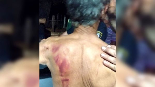 Torturaron a abuelos con plancha caliente y machete en asalto