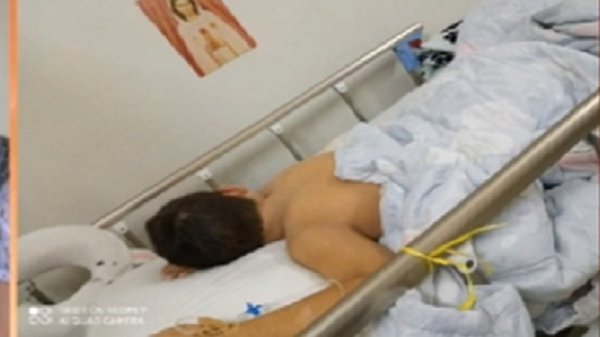 Peligroso juego en Tik tok causó quemaduras de tercer grado en un niño | Noticias Paraguay