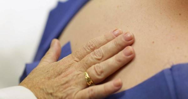 La Nación / Buscan diagnosticar de manera temprana el cáncer de piel para el correcto tratamiento