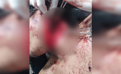 Indígena es hallado en charco de sangre en la terminal de Santa Rita