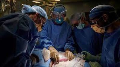 Histórico: trasplantaron un riñón de cerdo a un cuerpo humano y funcionó