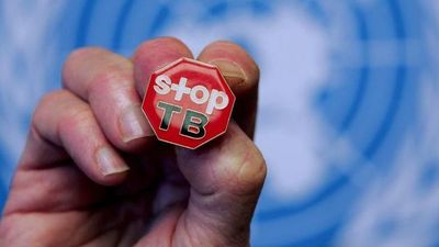 Esperanzador tratamiento contra la tuberculosis resistente - Mundo - ABC Color