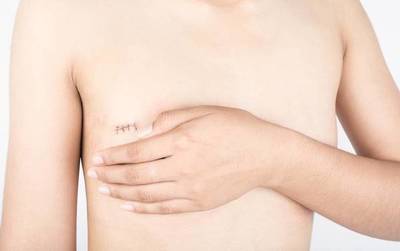 Impulsan proyecto de Ley de cobertura de reconstrucción mamaria para pacientes que vencieron el cáncer de mama