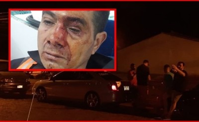 Guardia agredido por hermanos tras reclamo por el volumen de la música