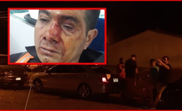 Guardia agredido por hermanos tras reclamo por el volumen de la música