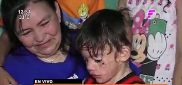 Niño necesita de la solidaridad de la gente para someterse a una cirugía | Noticias Paraguay