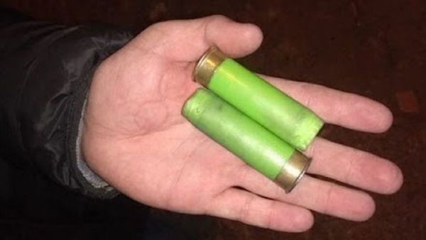 Joven fue herido en la mano por el arma de un policía en Limpio