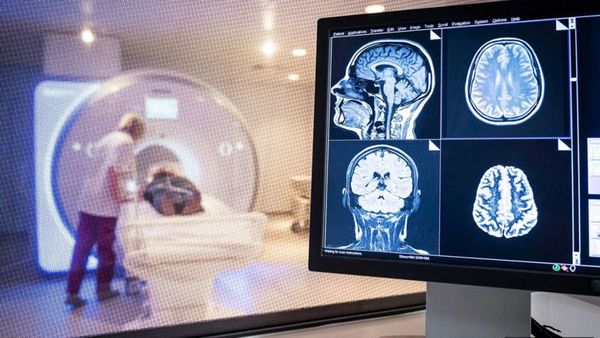 Nuevo estudio detecta secuelas cognitivas a largo plazo en personas que tuvieron coronavirus - .::Agencia IP::.