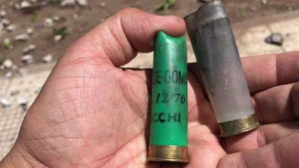 Limpio: Joven fue herido en la mano por el arma de un policía | Noticias Paraguay