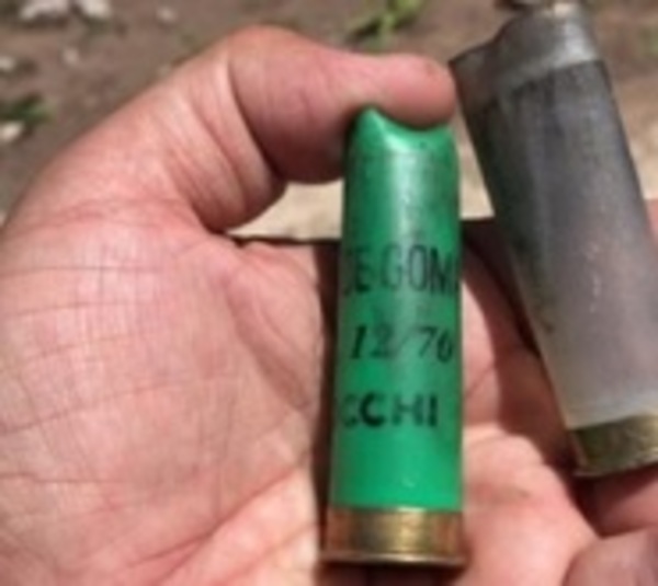 Limpio: Joven fue herido en la mano por el arma de un policía - Paraguay.com