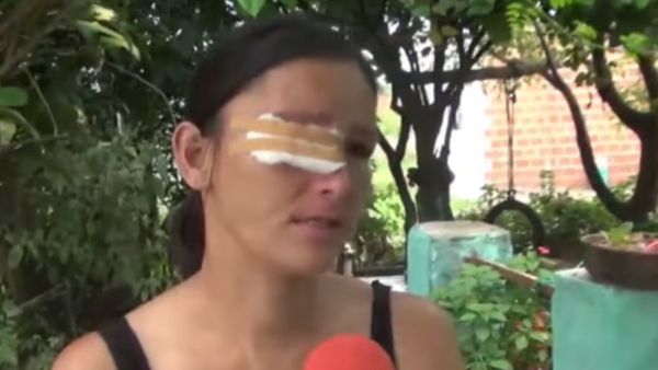 Garza le picoteó en el ojo y necesita operarse urgente
