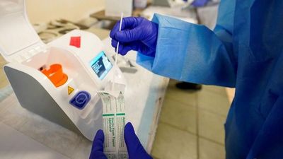 Científicos hallan método para evitar infección con el coronavirus