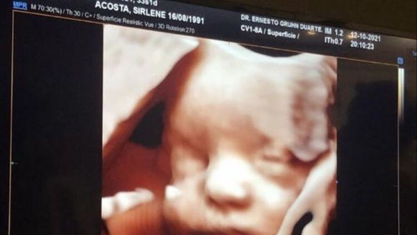 ¡Dale Candela!:  Papás ya están en EE. UU y esperan llegar a la meta