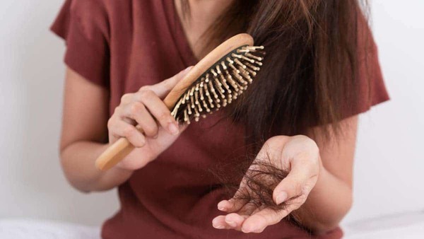 Las mujeres también sufren alopecia - El Independiente
