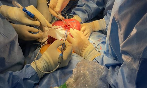 Exitosa sexta cirugía intrauterina a una gestante con 27 semanas
