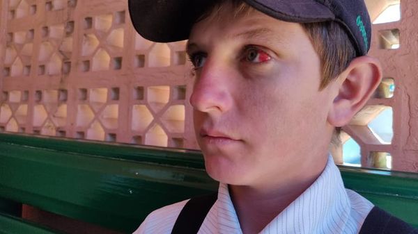 Joven menonita que sufrió brutal golpiza fue escondido por su padre - Nacionales - ABC Color