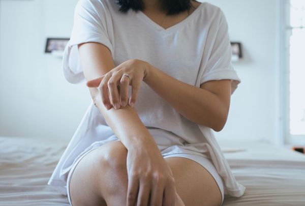 Lo que implica vivir con psoriasis - Nacionales - ABC Color