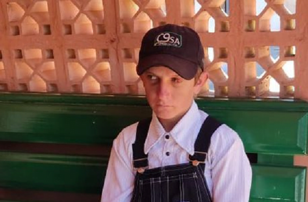 Estudios revelan graves fracturas en el rostro del joven menonita agredido - Noticiero Paraguay