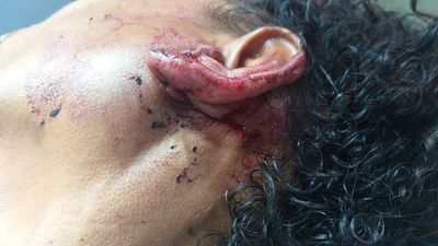 Balean a recolectora de latas desde una moto