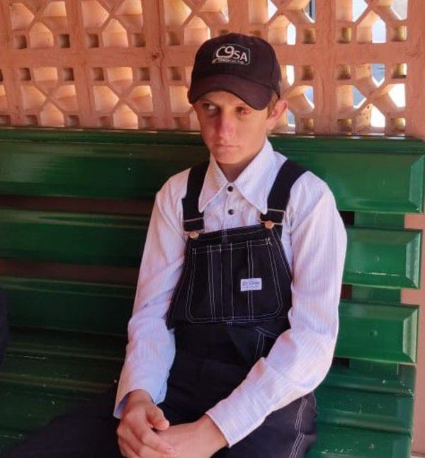 Joven menonita finalmente será operado tras golpiza - Nacionales - ABC Color