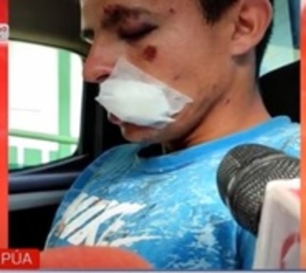 Golpean y reducen a hombre que habría intentado hurtar una moto - Paraguay.com