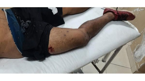 Ex convicto es herido en la Chacarita