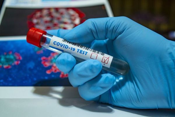 El mundo supera los 250 millones de casos de Covid-19
