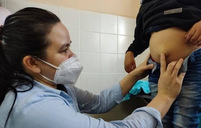 Diario HOY | Un total de 28 niños serán beneficiados con cirugías ambulatorias