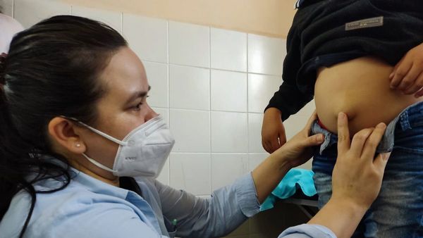 Tras casi dos años de espera, 28 niños accederán a cirugía