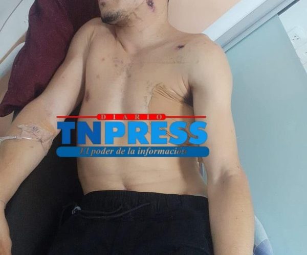 Presunto sicario brasileño detenido tras atentado fallido en la zona de Caazapá cuenta con antecedente en su país – Diario TNPRESS