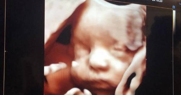La Nación / Dale Candela: aseguran cobertura médica para el nacimiento y tratamiento en EEUU