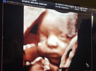 Dale Candela: aseguran cobertura médica para el nacimiento y tratamiento en EEUU – Prensa 5