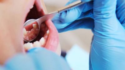 Niña murió por presunta sobredosis de anestesia tras ir a dentista