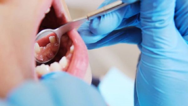 Niña murió por presunta sobredosis de anestesia tras ir a dentista