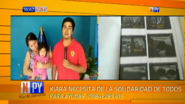 Realizan colecta para beba Kiara, quien corre riesgo de muerte por quiste