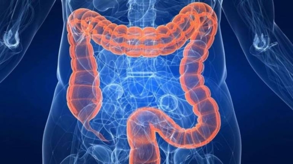 Diario HOY | Diabetes aumenta el riesgo de padecer cáncer colorrectal
