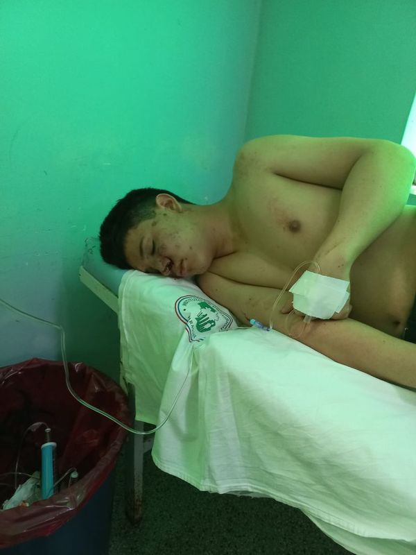 15 jóvenes roban y golpean gravemente a chico durante un evento en Villa Hayes - Nacionales - ABC Color