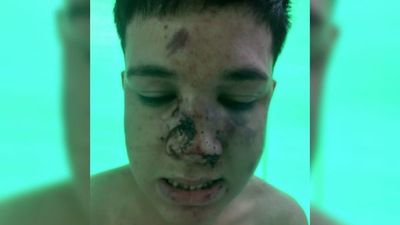 Desfiguraron a los golpes el rostro de un joven entre 15