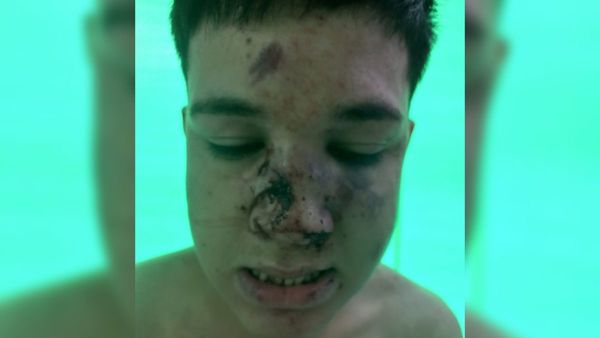 Desfiguraron a los golpes el rostro de un joven entre 15
