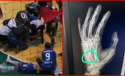 Sin ambulancias: tres jugadores fueron hospitalizados tras el clásico