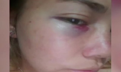 Denuncia Ciudadana: Jóvenes agredidas piden acompañamiento de las autoridades - SNT