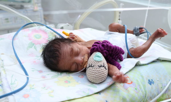 Fundación Visión trabaja para prevenir la ceguera irreversible en bebés prematuros