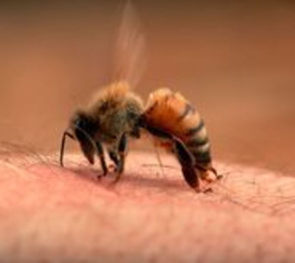 Abejas atacan a una familia en Fernando de la Mora - Paraguay.com