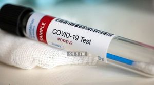 Reportan 45 nuevos casos y 2 fallecidos por COVID-19, ambos no vacunados
