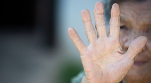 Alzheimer, el tipo de demencia más conocido