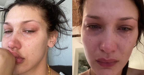 “Las redes sociales no son reales”: El conmovedor mensaje de Bella Hadid para concienciar sobre la salud mental - C9N