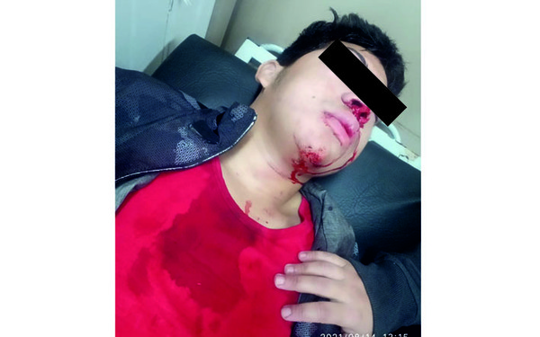 Brasilero quien cometió accidente y huyó está investigado por millonaria evasión | DIARIO PRIMERA PLANA