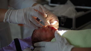 Fundación Visión trabaja para prevenir la ceguera irreversible en bebés prematuros