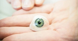 Diario HOY | Un londinense recibirá una prótesis ocular impresa en 3D, una primicia mundial